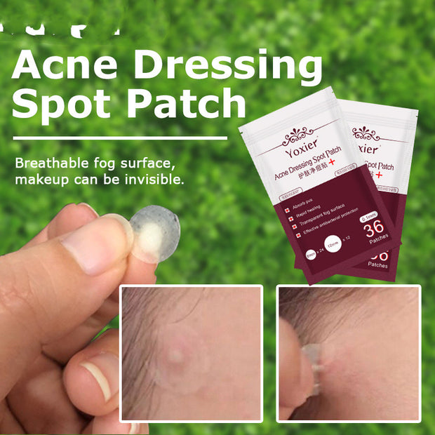 Skin Care Tools Acne Dressing Spot Patch Blemish Treatment Invisible Acne Stickers Pimple Remover Set Face Cream