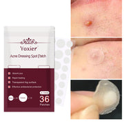 Skin Care Tools Acne Dressing Spot Patch Blemish Treatment Invisible Acne Stickers Pimple Remover Set Face Cream